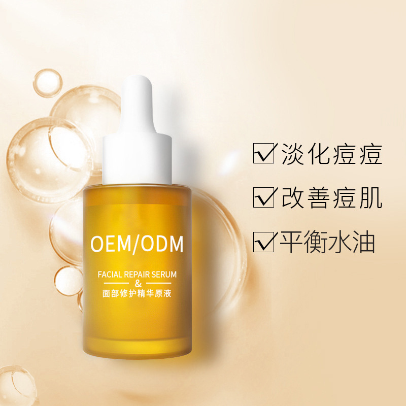 玉林市_祛痘精华原液OEM